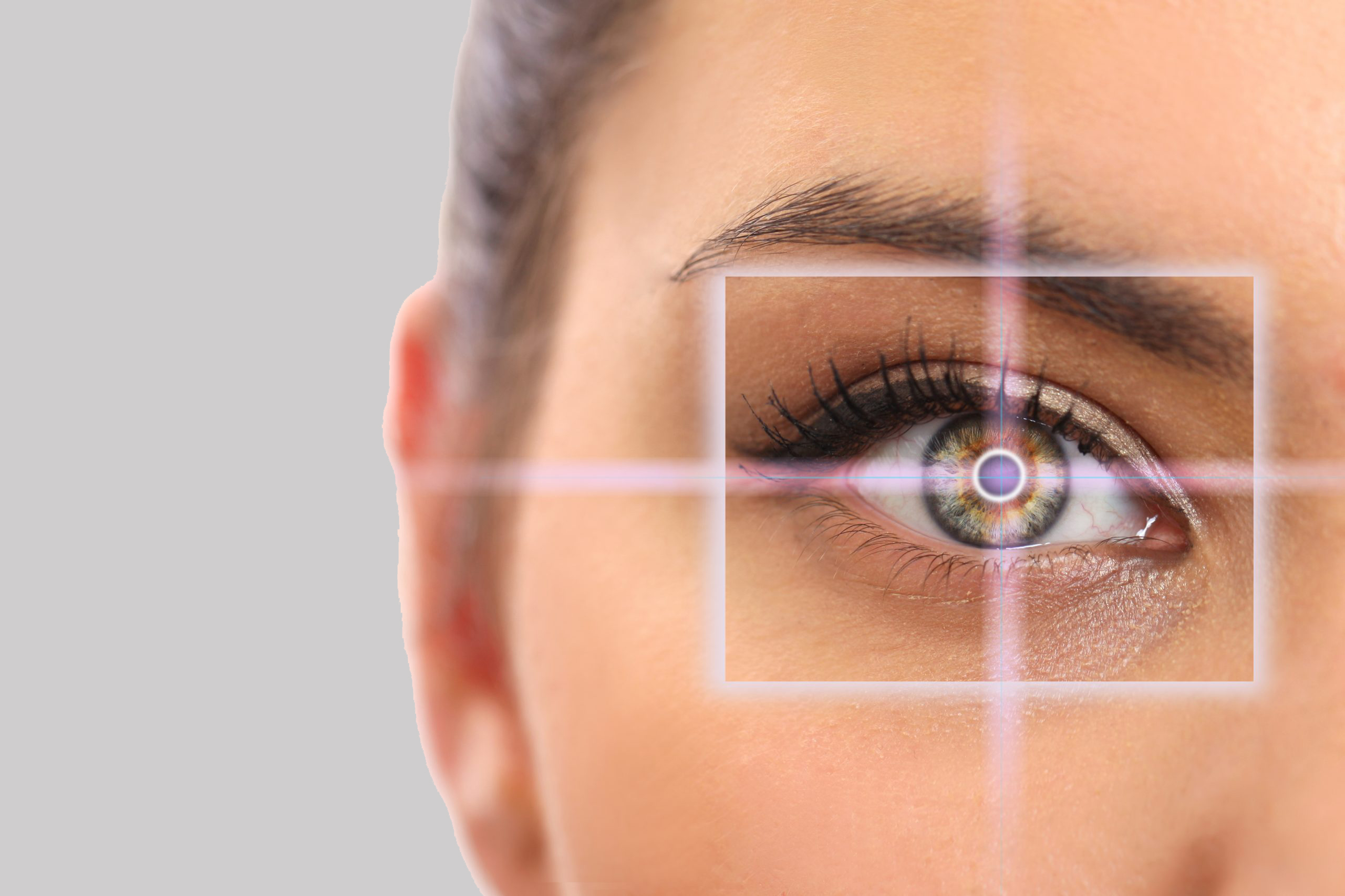 LASIK & Refractive Surgery in Brampton and Mississauga